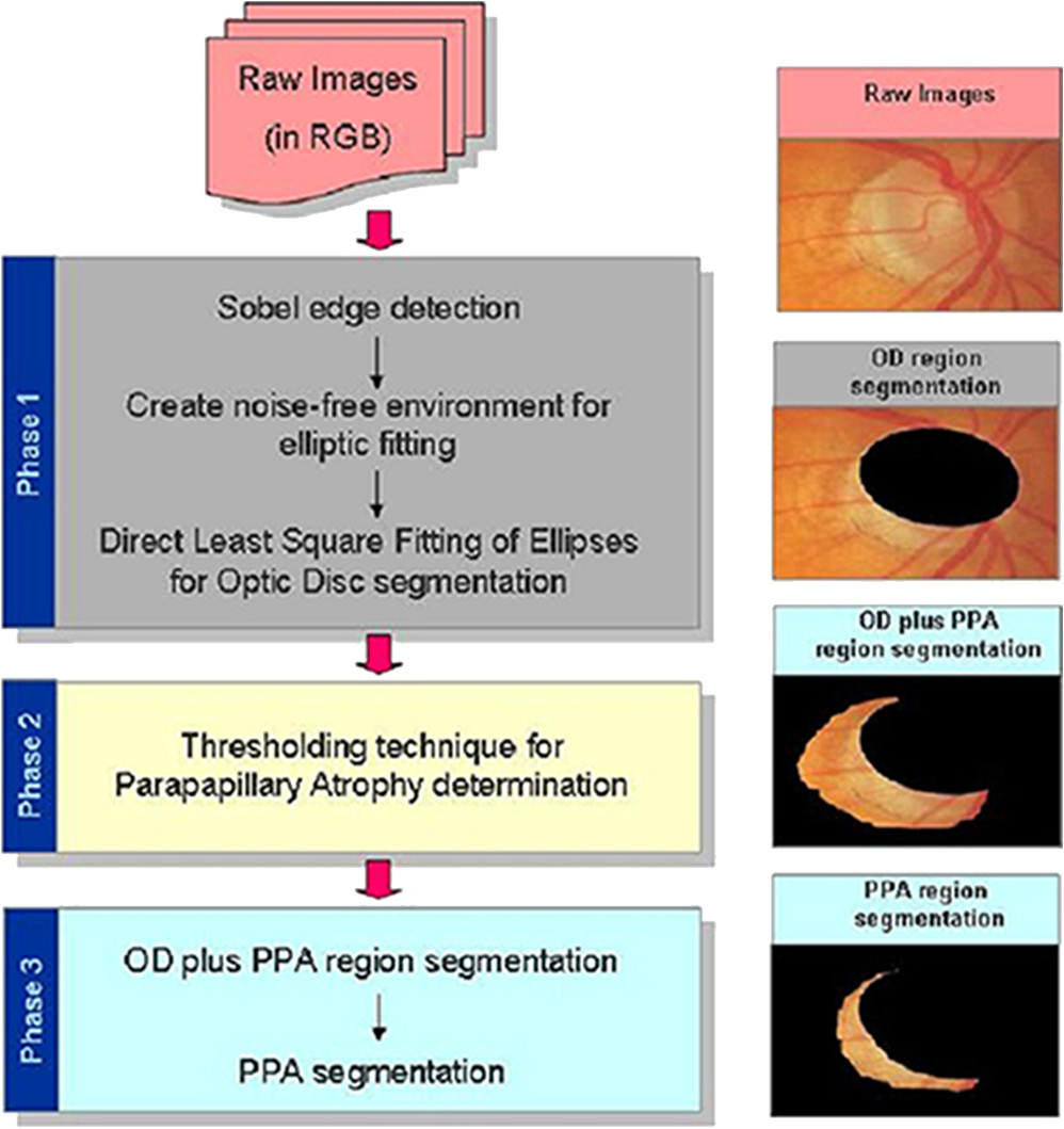 global views green vase of parapapillary atrophy and optic disc region assessment pandora within a flow chart for segmentation of the od and ppa the scheme consists of three main phases od segmentation gray ppa detection pale yellow